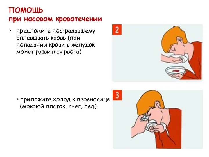 ПОМОЩЬ при носовом кровотечении предложите пострадавшему сплевывать кровь (при попадании крови