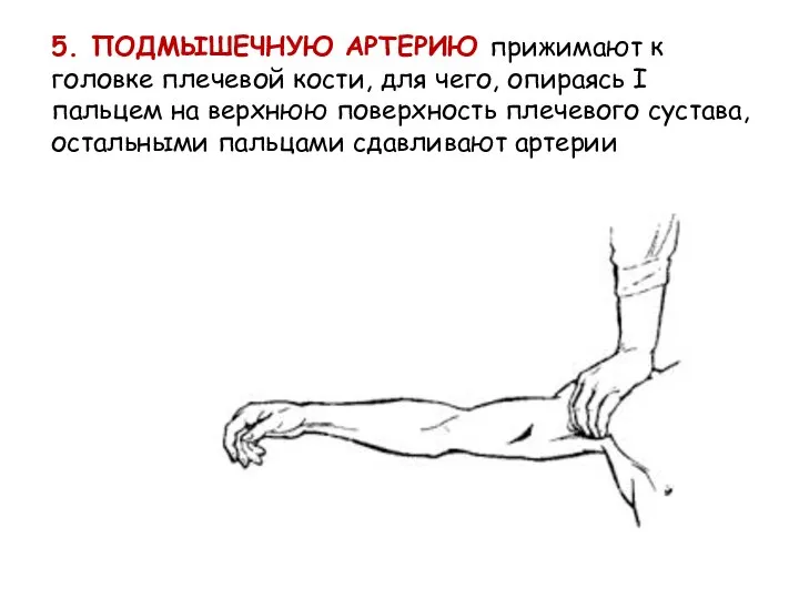 5. ПОДМЫШЕЧНУЮ АРТЕРИЮ прижимают к головке плечевой кости, для чего, опираясь