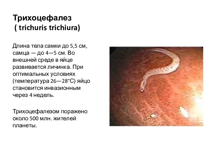 Трихоцефалез ( trichuris trichiura) Длина тела самки до 5,5 см, самца