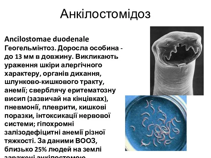 Анкілостомідоз Ancilostomae duodenale Геогельмінтоз. Доросла особина - до 13 мм в