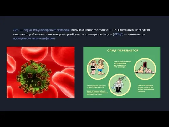 ВИЧ — вирус иммунодефицита человека, вызывающий заболевание — ВИЧ-инфекцию, последняя стадия