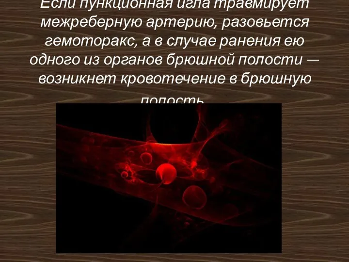 Если пункционная игла травмирует межреберную артерию, разовьется гемоторакс, а в случае