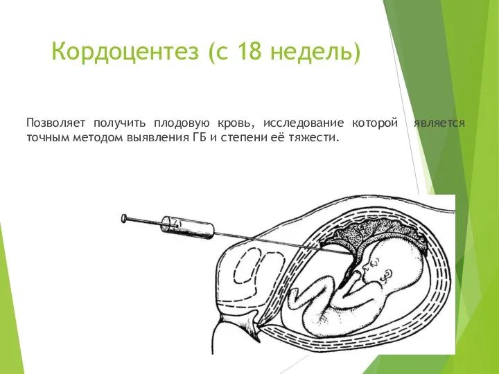 Кордоцентез (с 18 недель) Позволяет получить плодовую кровь, исследование которой является