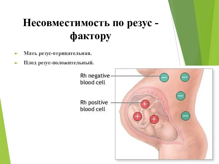 Несовместимость по резус - фактору Мать резус-отрицательная. Плод резус-положительный.