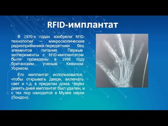 RFID-имплантат В 1970-х годах изобрели RFID-технологии — микроскопические радиоприёмники-передатчики без элементов