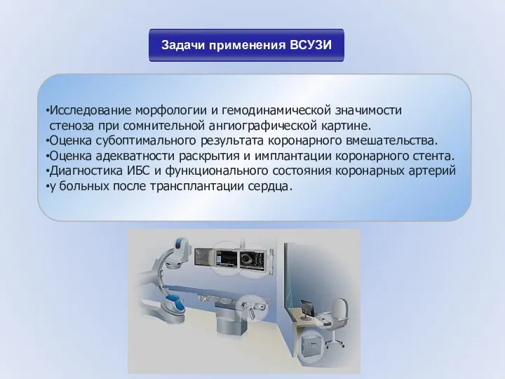 Исследование морфологии и гемодинамической значимости стеноза при сомнительной ангиографической картине. Оценка