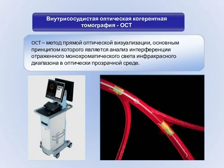 Внутрисосудистая оптическая когерентная томография - OCT OCT – метод прямой оптической