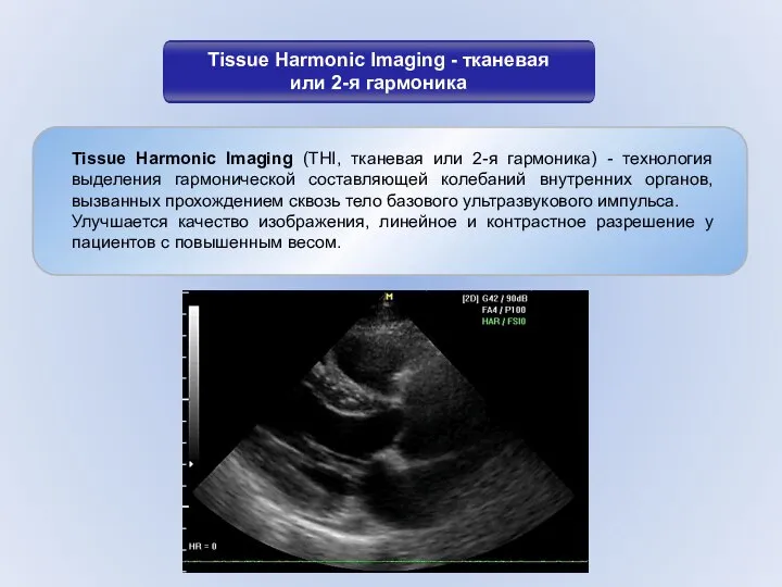 Tissue Harmonic Imaging - тканевая или 2-я гармоника Tissue Harmonic Imaging