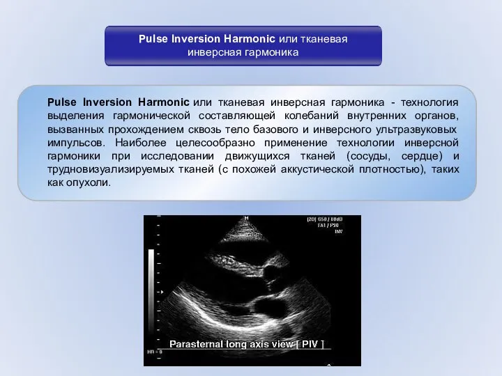 Pulse Inversion Harmonic или тканевая инверсная гармоника - технология выделения гармонической