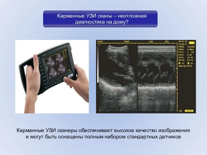 Карманные УЗИ сканы – неотложная диагностика на дому? Карманные УЗИ сканеры