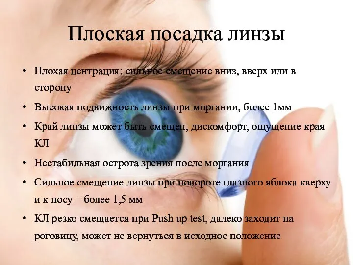 Плоская посадка линзы Плохая центрация: сильное смещение вниз, вверх или в