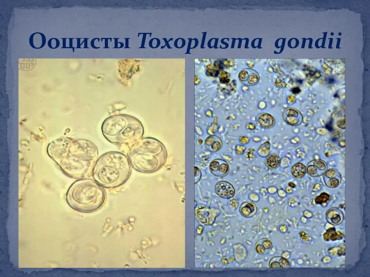 Ооцисты Toxoplasma gondii