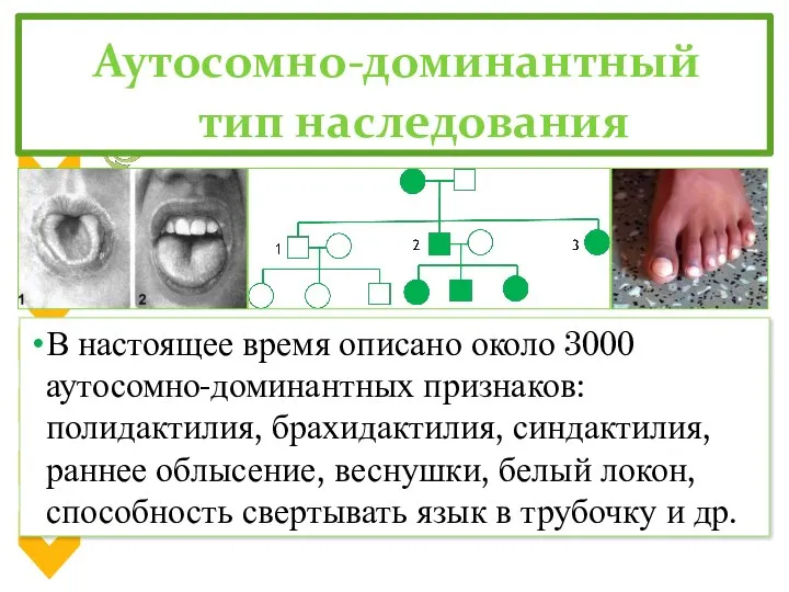 Аутосомно-доминантный тип наследования В настоящее время описано около 3000 аутосомно-доминантных признаков: