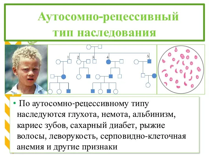 Аутосомно-рецессивный тип наследования По аутосомно-рецессивному типу наследуются глухота, немота, альбинизм, кариес