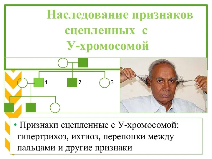 Наследование признаков сцепленных с У-хромосомой Признаки сцепленные с У-хромосомой: гипертрихоз, ихтиоз,