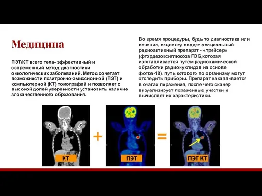 Медицина ПЭТ/КТ всего тела- эффективный и современный метод диагностики онкологических заболеваний.