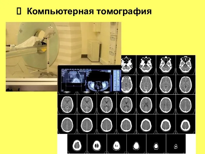 Компьютерная томография