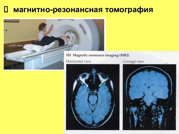 магнитно-резонансная томография