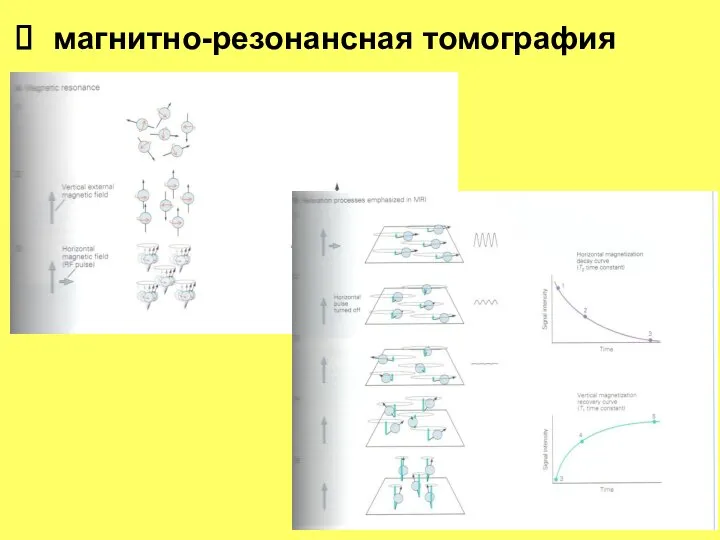 магнитно-резонансная томография