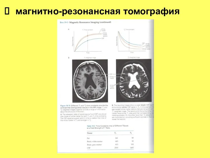 магнитно-резонансная томография