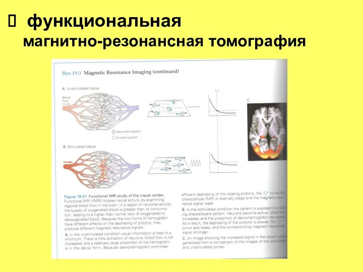 функциональная магнитно-резонансная томография