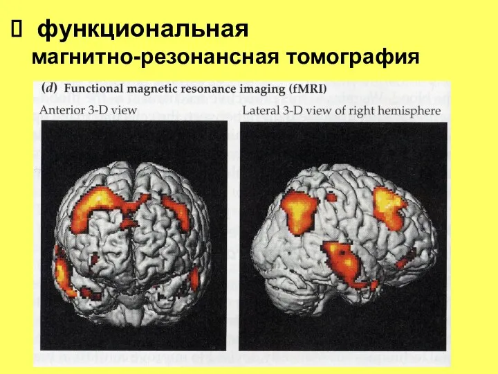 функциональная магнитно-резонансная томография