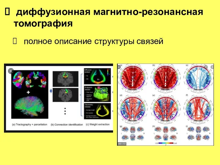 полное описание структуры связей диффузионная магнитно-резонансная томография