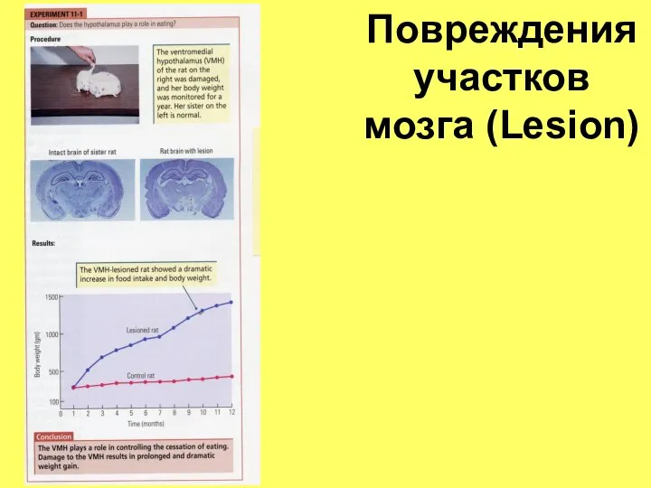 Повреждения участков мозга (Lesion)