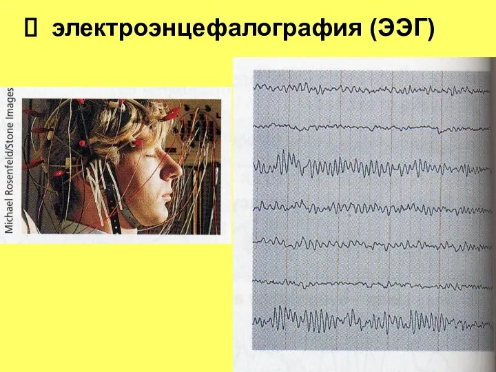 электроэнцефалография (ЭЭГ)