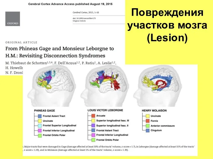 Повреждения участков мозга (Lesion)