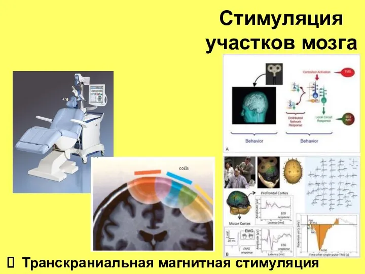 Стимуляция участков мозга Транскраниальная магнитная стимуляция