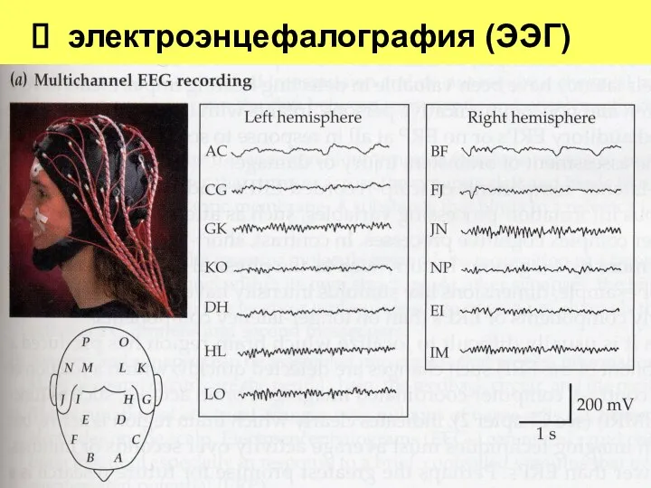 электроэнцефалография (ЭЭГ)