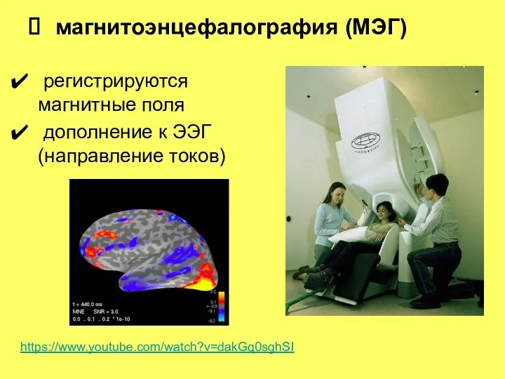 магнитоэнцефалография (МЭГ) регистрируются магнитные поля дополнение к ЭЭГ (направление токов) https://www.youtube.com/watch?v=dakGq0sghSI