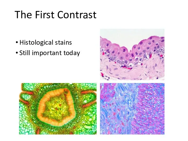 The First Contrast Histological stains Still important today