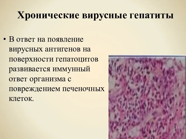 Хронические вирусные гепатиты В ответ на появление вирусных антигенов на поверхности