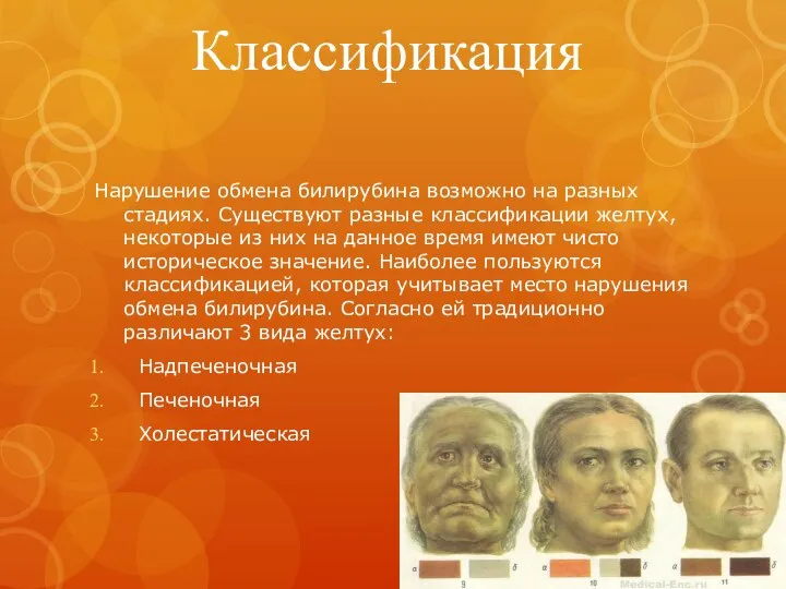 Классификация Нарушение обмена билирубина возможно на разных стадиях. Существуют разные классификации