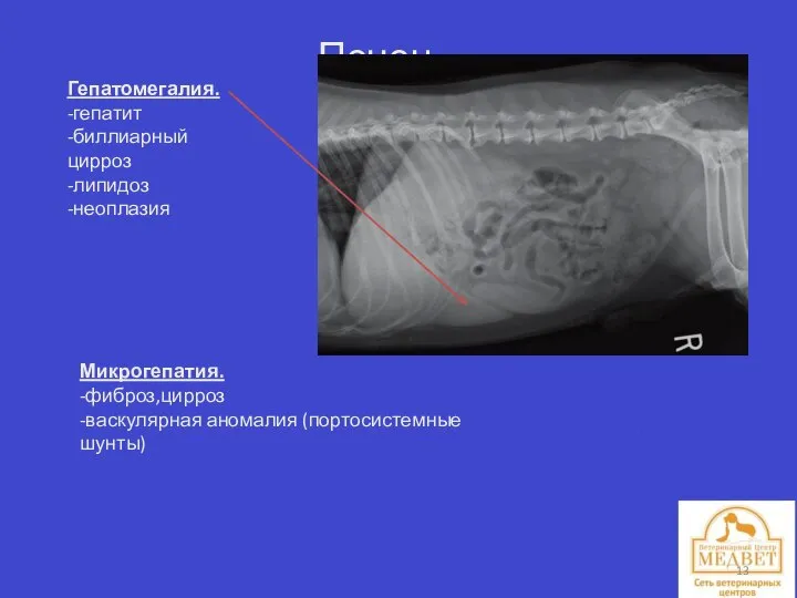 Печень. Гепатомегалия. -гепатит -биллиарный цирроз -липидоз -неоплазия Микрогепатия. -фиброз,цирроз -васкулярная аномалия (портосистемные шунты)