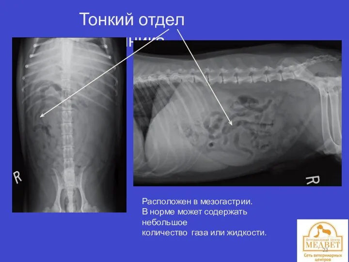 Тонкий отдел кишечника. Расположен в мезогастрии. В норме может содержать небольшое количество газа или жидкости.