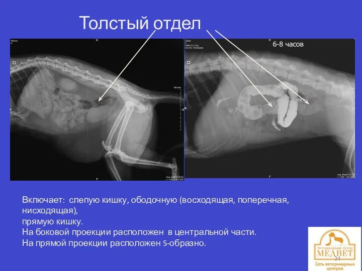 Толстый отдел кишечника. Включает: слепую кишку, ободочную (восходящая, поперечная, нисходящая), прямую