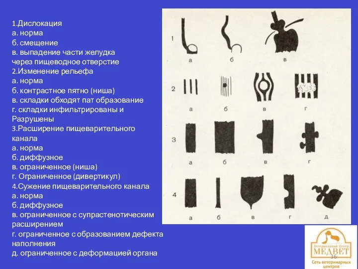 1.Дислокация а. норма б. смещение в. выпадение части желудка через пищеводное