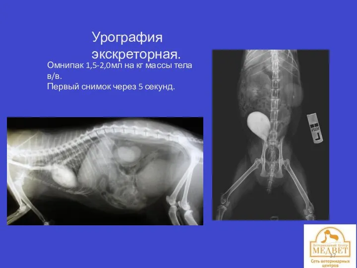 Урография экскреторная. Омнипак 1,5-2,0мл на кг массы тела в/в. Первый снимок через 5 секунд.