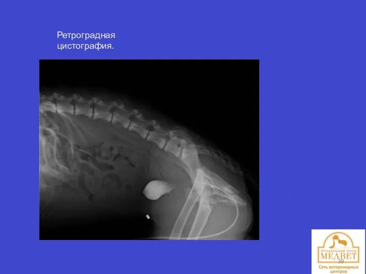 Ретроградная цистография.