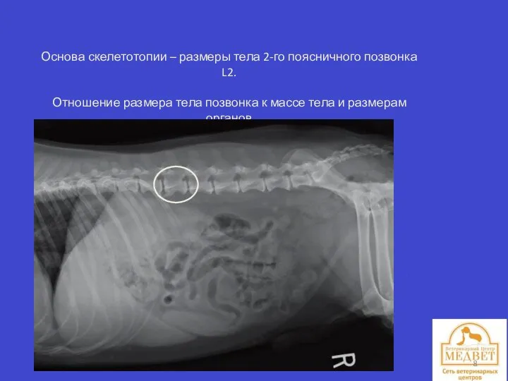 Основа скелетотопии – размеры тела 2-го поясничного позвонка L2. Отношение размера