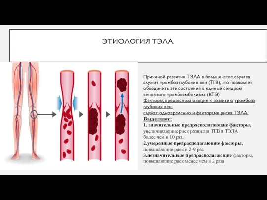 ЭТИОЛОГИЯ ТЭЛА. Причиной развития ТЭЛА в большинстве случаев служит тромбоз глубоких