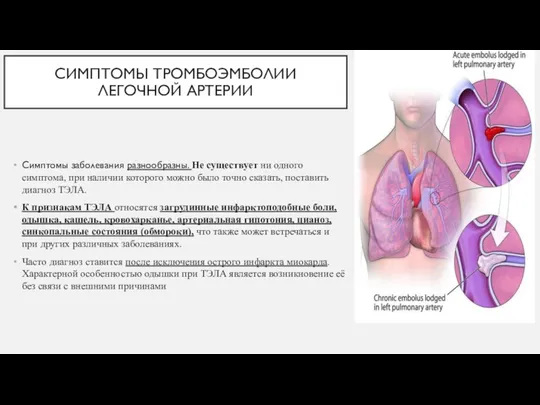 СИМПТОМЫ ТРОМБОЭМБОЛИИ ЛЕГОЧНОЙ АРТЕРИИ Симптомы заболевания разнообразны. Не существует ни одного