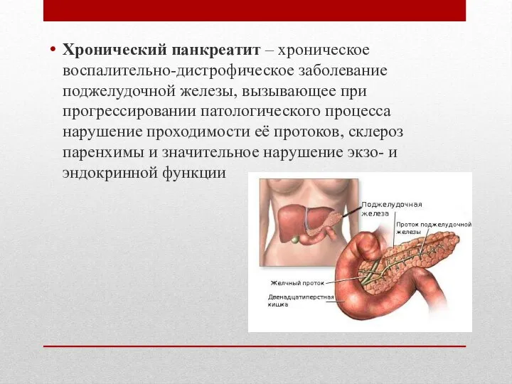 Хронический панкреатит – хроническое воспалительно-дистрофическое заболевание поджелудочной железы, вызывающее при прогрессировании