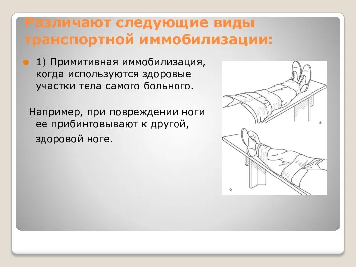 Различают следующие виды транспортной иммобилизации: 1) Примитивная иммобилизация, когда используются здоровые