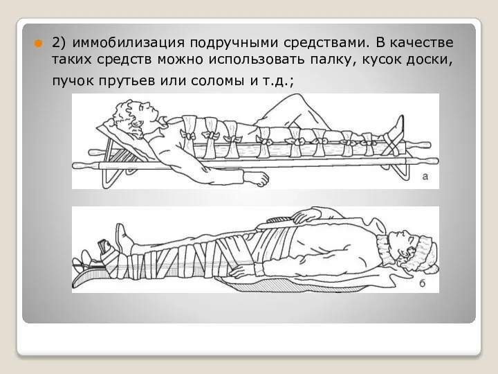 2) иммобилизация подручными средствами. В качестве таких средств можно использовать палку,