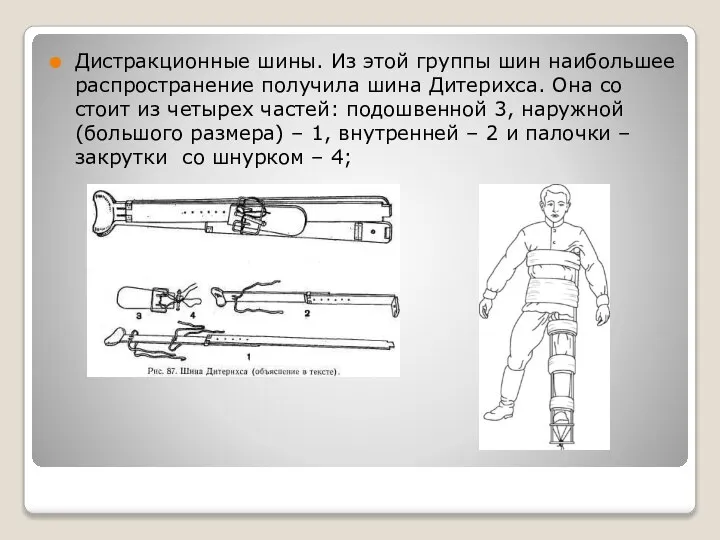 Дистракционные шины. Из этой группы шин наибольшее распространение получила шина Дитерихса.