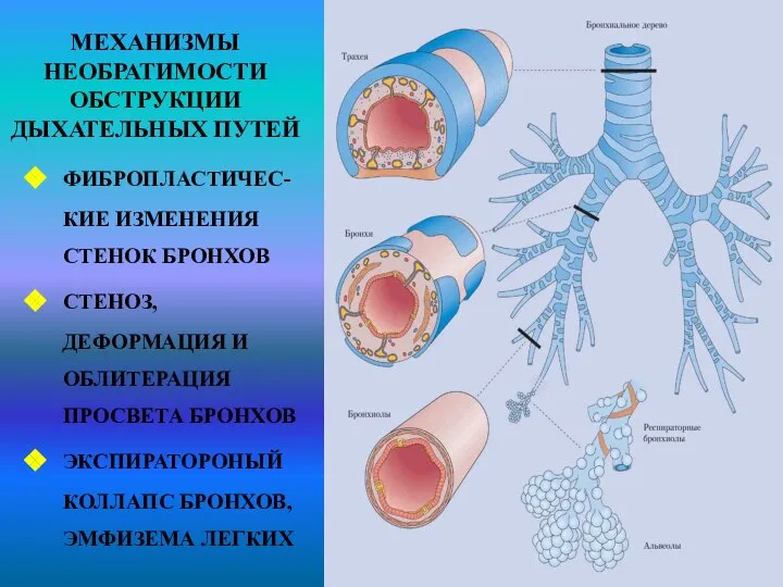 МЕХАНИЗМЫ НЕОБРАТИМОСТИ ОБСТРУКЦИИ ДЫХАТЕЛЬНЫХ ПУТЕЙ ФИБРОПЛАСТИЧЕС-КИЕ ИЗМЕНЕНИЯ СТЕНОК БРОНХОВ СТЕНОЗ, ДЕФОРМАЦИЯ